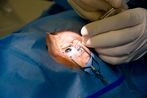 The LASIK technique is used to treat: