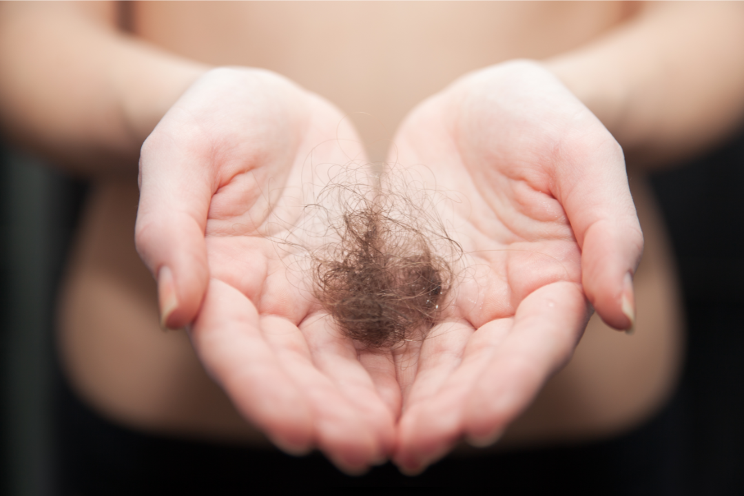 6 Foods to Prevent Hair Loss